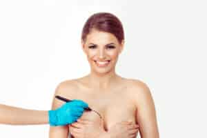 A doctor marking a woman’s breasts for breast reduction