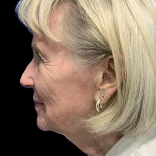 B&A