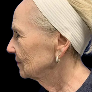 B&A