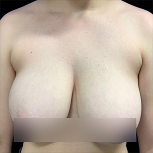 B&A